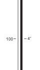 Type  LSN  (100mm - 160mm) 